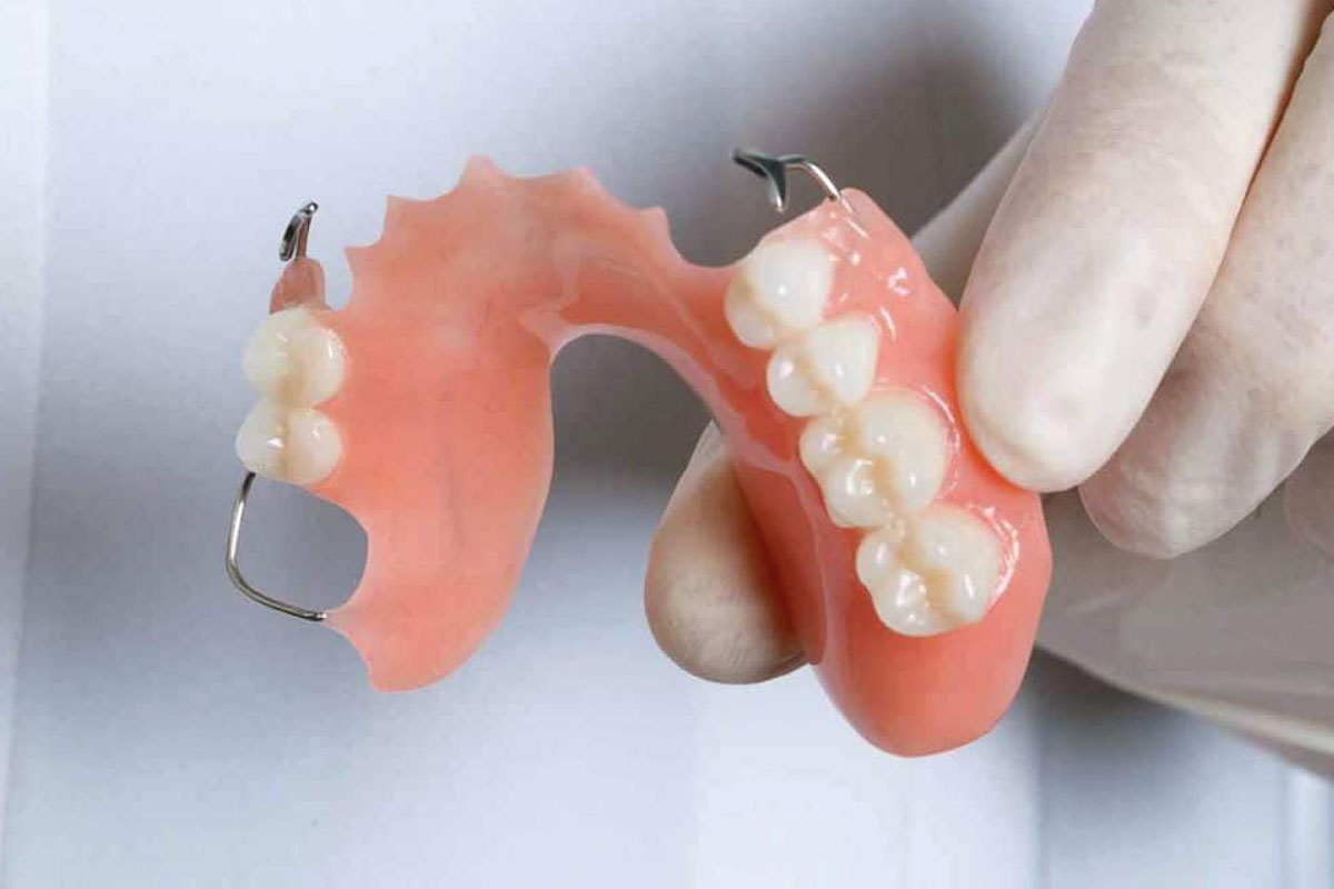 Partial Acrylic Dentures