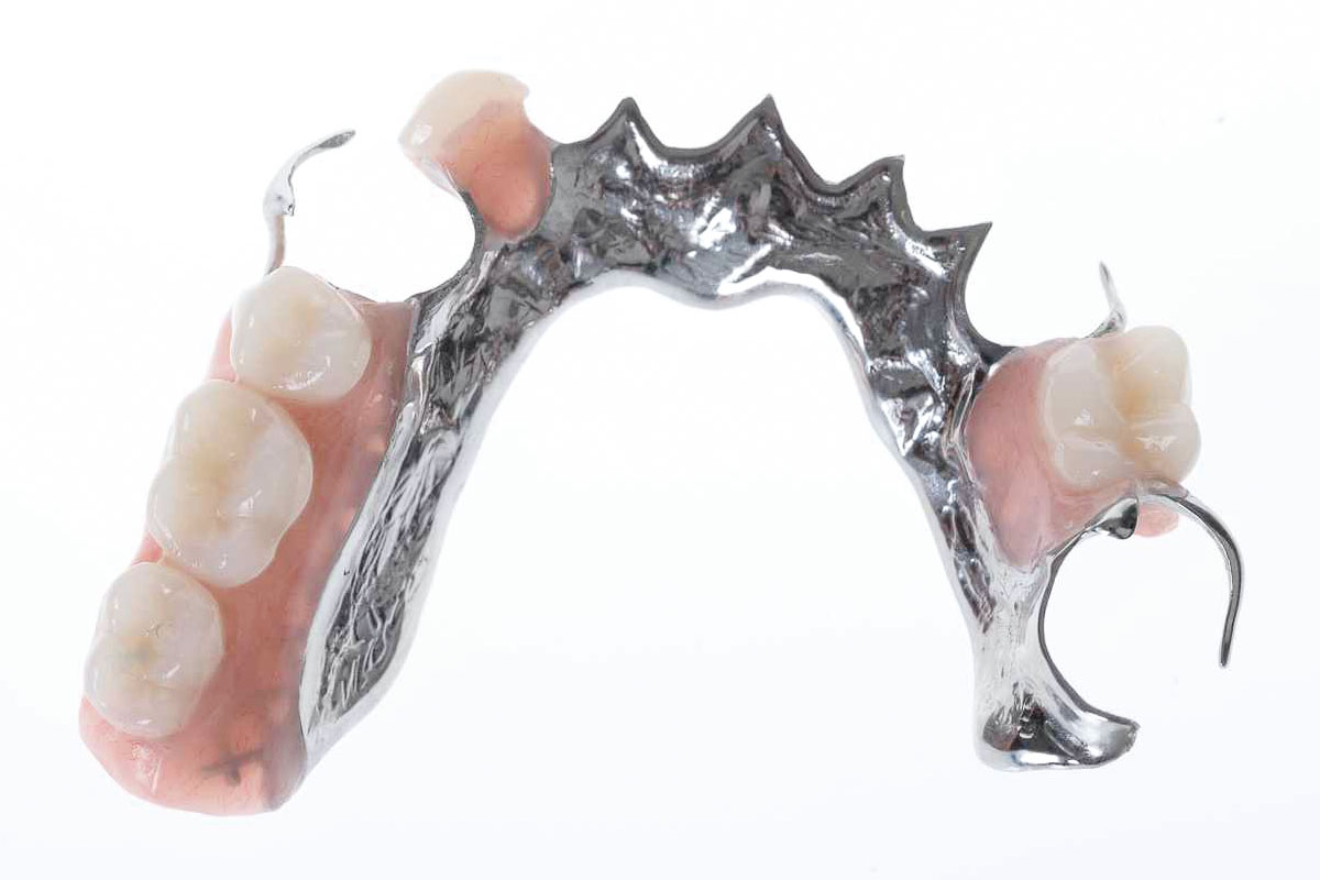 Chrome Cobalt Dentures