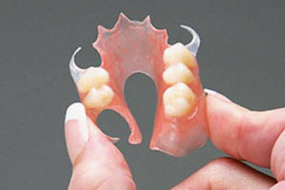 Flexible Dentures