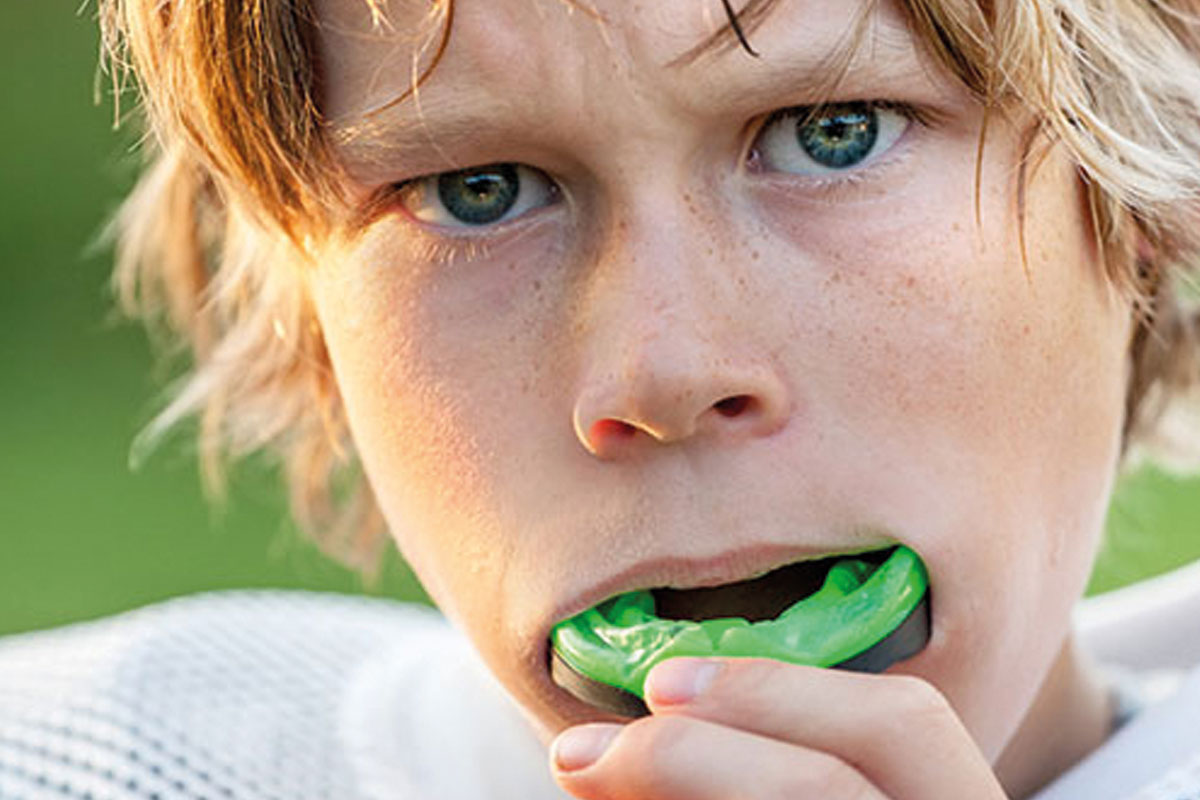 Mouth guards